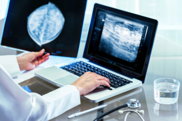 Doctor reviewing mammography results